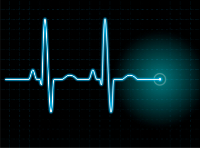 Electrocardiogram (EKG)