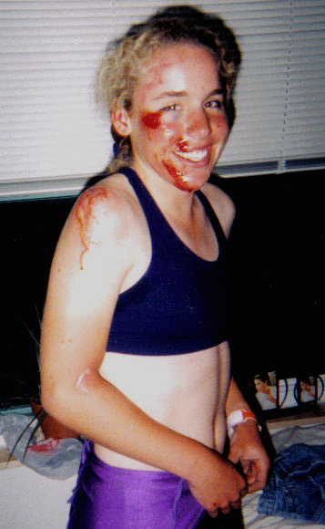 Erin Mirabella After Crash